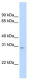 Transcription Factor A, Mitochondrial antibody, TA341820, Origene, Western Blot image 