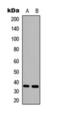 Corticosteroid 11-beta-dehydrogenase isozyme 1 antibody, orb393074, Biorbyt, Western Blot image 