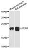 Regenerating Family Member 4 antibody, A13129, ABclonal Technology, Western Blot image 