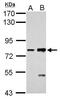 Cadherin-6 antibody, PA5-29984, Invitrogen Antibodies, Western Blot image 