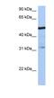 Zinc Finger Protein 14 antibody, NBP1-79388, Novus Biologicals, Western Blot image 