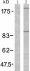 Insulin Like Growth Factor 1 Receptor antibody, TA321220, Origene, Western Blot image 