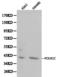 RNA Polymerase I And III Subunit C antibody, A07025-1, Boster Biological Technology, Western Blot image 
