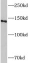 Adenylate Cyclase 8 antibody, FNab00158, FineTest, Western Blot image 