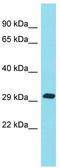 Katanin Regulatory Subunit B1 Like 1 antibody, TA330747, Origene, Western Blot image 