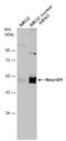 Neuronal Differentiation 1 antibody, GTX133207, GeneTex, Western Blot image 