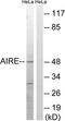 Autoimmune Regulator antibody, TA313459, Origene, Western Blot image 