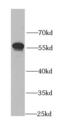 Aldehyde Dehydrogenase 3 Family Member A1 antibody, FNab00292, FineTest, Western Blot image 