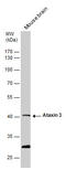 ATXN3 antibody, TA308320, Origene, Western Blot image 