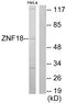 Zinc Finger Protein 18 antibody, LS-C118795, Lifespan Biosciences, Western Blot image 