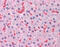 Hemoglobin Subunit Beta antibody, 51-463, ProSci, Immunohistochemistry paraffin image 