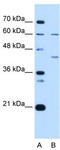 Replication factor C subunit 5 antibody, TA339306, Origene, Western Blot image 