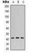 Mevalonate kinase antibody, orb318779, Biorbyt, Western Blot image 
