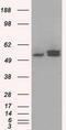ATP Synthase F1 Subunit Beta antibody, TA500851S, Origene, Western Blot image 