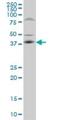 FRA10A Associated CGG Repeat 1 antibody, H00118924-M02, Novus Biologicals, Western Blot image 