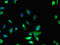 Myosin-X antibody, LS-C678729, Lifespan Biosciences, Immunofluorescence image 