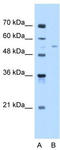 Fatty Acyl-CoA Reductase 2 antibody, TA342356, Origene, Western Blot image 