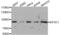 Argonaute RISC Component 1 antibody, abx004630, Abbexa, Western Blot image 