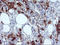 SERPINB2 antibody, LS-C173608, Lifespan Biosciences, Immunohistochemistry frozen image 