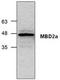 Methyl-CpG-binding domain protein 2 antibody, TA318881, Origene, Western Blot image 
