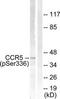 C-C Motif Chemokine Receptor 5 (Gene/Pseudogene) antibody, TA313324, Origene, Western Blot image 
