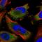 Makorin Ring Finger Protein 2 antibody, HPA037559, Atlas Antibodies, Immunocytochemistry image 