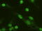 Mitogen-activated protein kinase 6 antibody, TA500077, Origene, Immunofluorescence image 