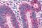 Melanin Concentrating Hormone Receptor 1 antibody, NLS1533, Novus Biologicals, Immunohistochemistry paraffin image 