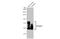 SYN2 antibody, GTX635885, GeneTex, Western Blot image 