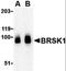 BR Serine/Threonine Kinase 1 antibody, orb86538, Biorbyt, Western Blot image 