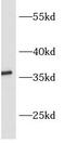 Retroviral-like aspartic protease 1 antibody, FNab00647, FineTest, Western Blot image 
