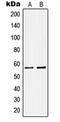 Potassium Voltage-Gated Channel Subfamily A Member 1 antibody, orb214147, Biorbyt, Western Blot image 