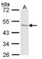 Acid Phosphatase, Prostate antibody, TA308808, Origene, Western Blot image 