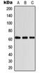 Coenzyme A Synthase antibody, orb215302, Biorbyt, Western Blot image 