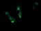 RCAN Family Member 3 antibody, M11135, Boster Biological Technology, Immunofluorescence image 