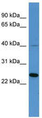 MAS Related GPR Family Member X3 antibody, TA342779, Origene, Western Blot image 