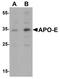 Apolipoprotein E antibody, TA326636, Origene, Western Blot image 