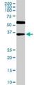 Homeobox protein CDX-4 antibody, H00001046-M12, Novus Biologicals, Western Blot image 