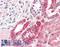 Tyrosine Kinase 2 antibody, LS-B9432, Lifespan Biosciences, Immunohistochemistry frozen image 