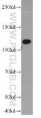 ATP Citrate Lyase antibody, 15421-1-AP, Proteintech Group, Western Blot image 