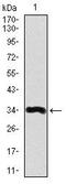 Lipoprotein(A) antibody, MA5-17111, Invitrogen Antibodies, Western Blot image 