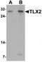 T Cell Leukemia Homeobox 2 antibody, TA319662, Origene, Western Blot image 