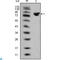 ISL LIM Homeobox 1 antibody, LS-C812662, Lifespan Biosciences, Western Blot image 