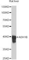 Alcohol Dehydrogenase 1B (Class I), Beta Polypeptide antibody, STJ22517, St John
