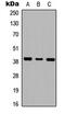 Galanin Receptor 1 antibody, MBS8240326, MyBioSource, Western Blot image 