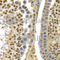 DNA dC->dU-editing enzyme APOBEC-3G antibody, A1459, ABclonal Technology, Immunohistochemistry paraffin image 