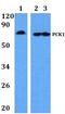 Phosphoenolpyruvate Carboxykinase 1 antibody, A02022, Boster Biological Technology, Western Blot image 