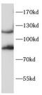 BCAR1 Scaffold Protein, Cas Family Member antibody, FNab10802, FineTest, Western Blot image 
