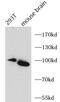 Fibroblast Growth Factor Receptor 3 antibody, FNab10801, FineTest, Western Blot image 