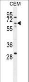 Zinc Finger Protein 674 antibody, LS-C160934, Lifespan Biosciences, Western Blot image 